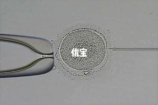 睾丸穿刺和显微取精是不同的