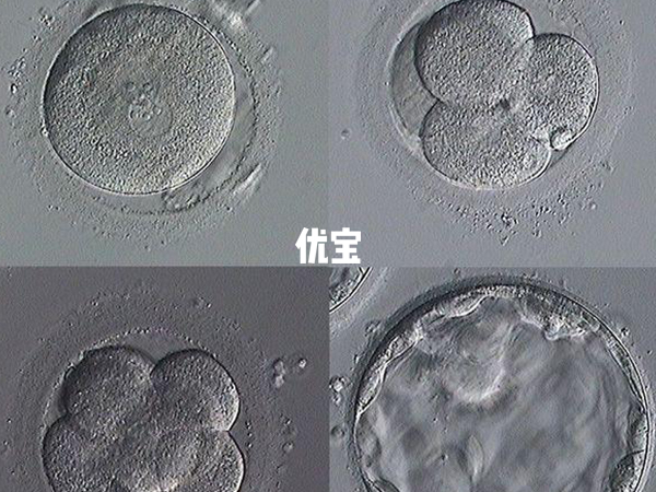 养囊5天发育缓慢首先需要找明原因