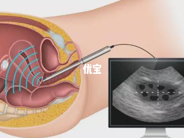 托马斯通过人工授精代妻怀孕