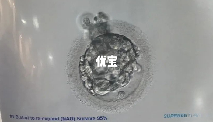 囊胚冷冻了九年对质量并无影响